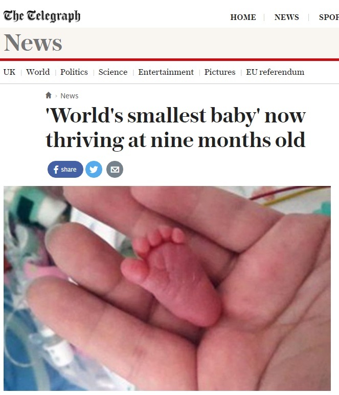 Emilia, la neonata più piccola al mondo: pesava 225 grammi