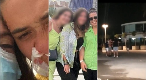 «Picchiate dalla polizia in Spagna», la denuncia di 8 ragazze italiane. L'incubo fuori da una discoteca