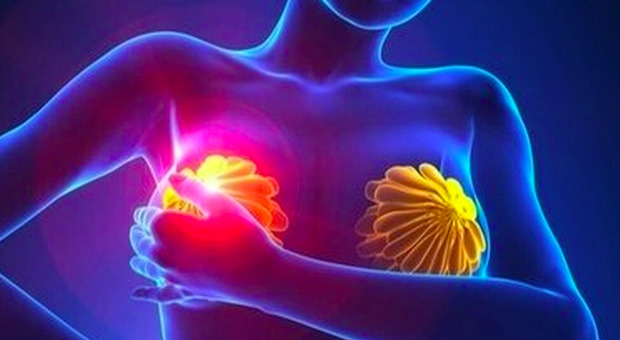Tumore al seno, scoperto un farmaco «rivoluzionario» che riduce le metastasi e blocca l'avanzamento della malattia
