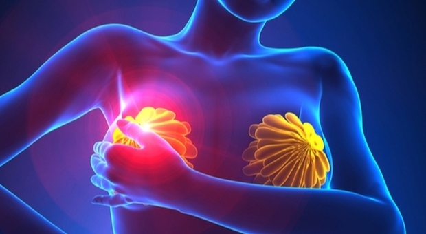 Tumore al seno avanzato, nuove terapie allungano di 4 anni la sopravvivenza