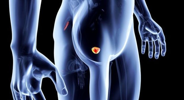 terapia prostata tumore