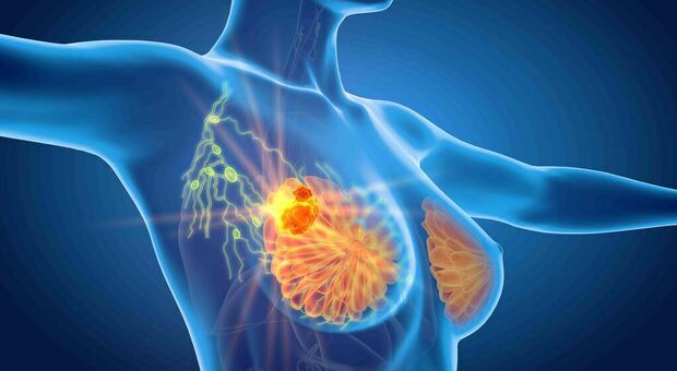 Tumore al seno, scoperta la proteina che protegge il cuore delle donne dai danni della chemioterapia