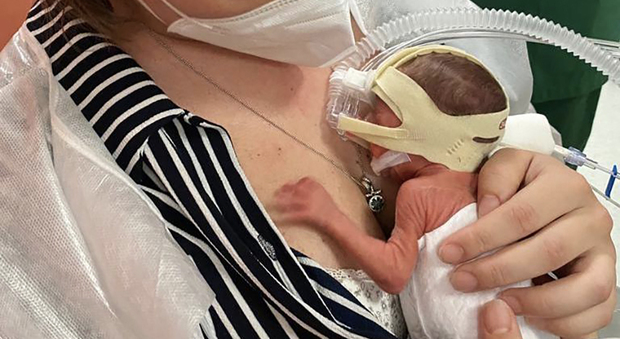 Castellammare, partorisce a 6 mesi di gestazione: alla luce neonato di soli 600 grammi