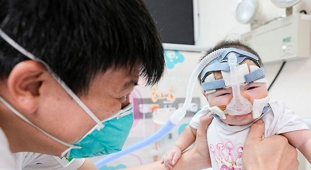 Singapore, torna a casa la neonata più piccola del mondo: pesava come una mela, dopo 13 mesi di cure sta bene
