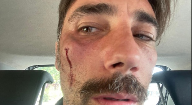 Striscia la Notizia: Vittorio Brumotti preso a pugni in provincia di Foggia «Non mi fermo»