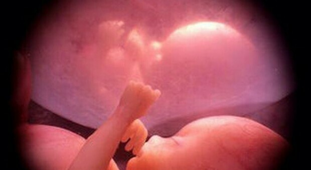 Catania, un anno dopo il primo trapianto di utero: «Adesso voglio essere madre»