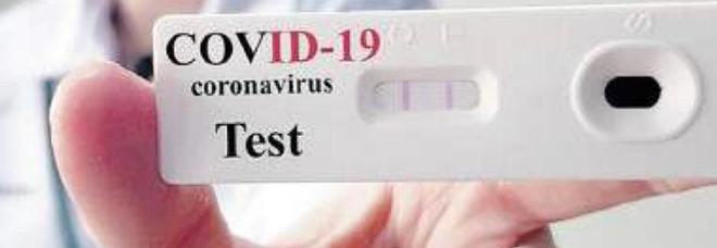 Covid 19, il test che si fa in 6 minuti: «Cambierà la lotta al virus»