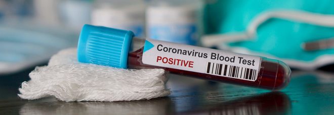 Coronavirus, gara-lampo della Consip: in arrivo 5.000 nuovi posti letto in terapia intensiva