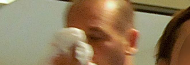 Nuova aggressione a un infermiere: colpi di casco al viso, naso fratturato