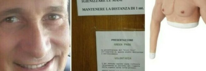 Guido Russo, il dentista col braccio in silicone per il vaccino: il cartello sul Green pass e la protesi comprata online