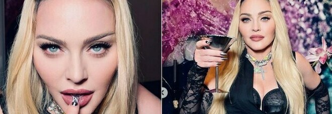 Madonna tra botox, spogliarelli e stravizi: la crisi d'identità di una star