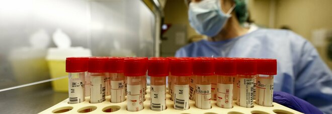 Virus, curva sempre in crescita: 70 nuovi casi nella Tuscia