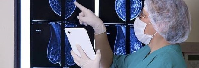 Tumore al seno, a Monza lo studio sperimentale per curarlo senza chemio
