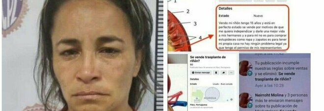 Un rene in vendita on line per 20mila dollari: arrestata una donna, la "donatrice" ha 15 anni e vuole sfamare i fratelli