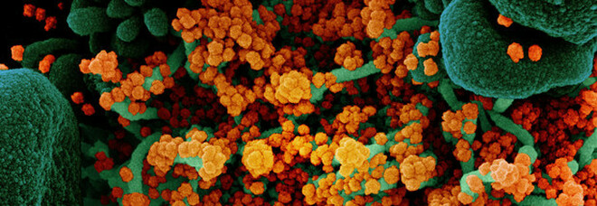 Febbre di Lassa, cos'è il virus simile all'Ebola: sintomi, incubazione, terapia e prevenzione