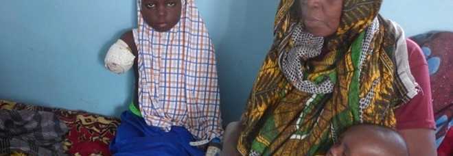 Hadjara, una bimba di 8 anni, mutilata da Boko Haram