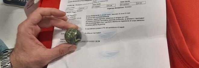 Napoli: bambino di 9 mesi ingoia una pallina di gomma, salvato dai medici del Cto