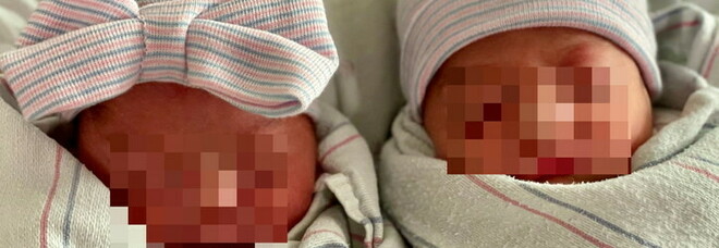 Una storia unica: due gemelli sono nati a distanza di 15 minuti, per cui hanno giorni, mesi e anni diversi