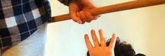 Picchia la moglie con un bastone, arrestato dalla polizia nel Napoletano