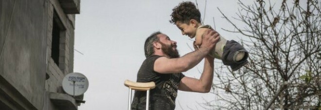 Bimbo e papà senza arti, ecco la foto simbolo del dramma siriano: vince il Siena photo awards