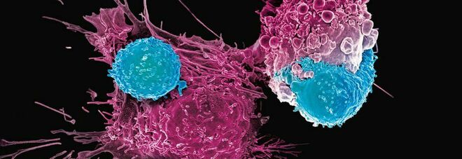 Cancro, nuove terapie geniche contro la leucemia sperimentate anche contro i tumori solidi