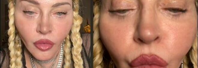 Madonna irriconoscibile nel video di TikTok, fan spaventati: «Cosa ti succede?»