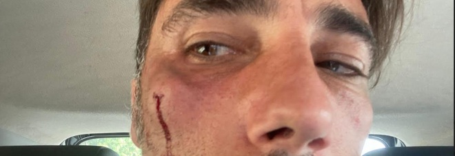 Striscia la Notizia: Vittorio Brumotti preso a pugni in provincia di Foggia «Non mi fermo»